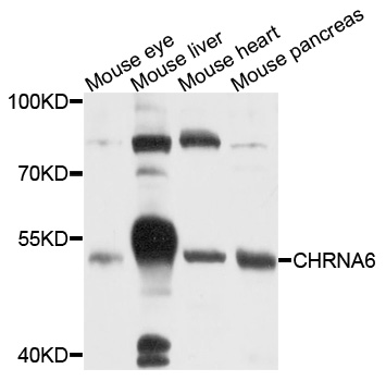 CHRNA6 Antibody - Western blot analysis of extracts of various cells.