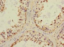 CHRNA6 Antibody - Immunohistochemistry of paraffin-embedded human testis tissue at dilution 1:100