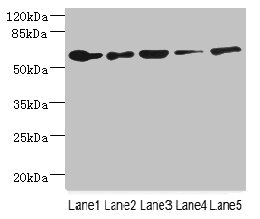 CHRNA6 Antibody - Western blot All Lanes: CHRNA6 antibody at 2.29ug/ml Lane 1: A431 whole cell lysate Lane 2: Thp-1 whole cell lysate Lane 3: A549 whole cell lysate Lane 4: Hela whole cell lysate Lane 5: HepG-2 whole cell lysate Secondary Goat polyclonal to rabbit IgG at 1/10000 dilution Predicted band size: 57,56 kDa Observed band size: 57 kDa