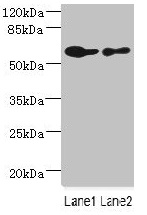 CHRNA6 Antibody - Western blot All lanes: CHRNA6 antibody at 2.29µg/ml Lane 1: A431 whole cell lysate Lane 2: THP-1 whole cell lysate Secondary Goat polyclonal to rabbit IgG at 1/10000 dilution Predicted band size: 57, 56 kDa Observed band size: 57 kDa