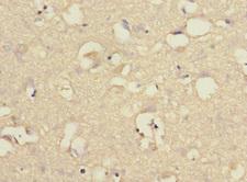 CHRNA6 Antibody - Immunohistochemistry of paraffin-embedded human brain tissue at dilution 1:100