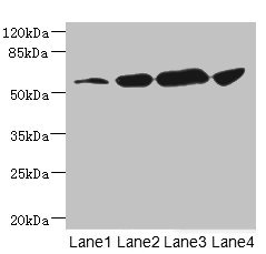 CHRNA6 Antibody - Western blot All Lanes: CHRNA6 antibody at 3.72ug/ml Lane 1: A431 whole cell lysate Lane 2: A549 whole cell lysate Lane 3: Hela whole cell lysate Lane 4: HepG-2 whole cell lysate Secondary Goat polyclonal to rabbit IgG at 1/10000 dilution Predicted band size: 57,56 kDa Observed band size: 57 kDa