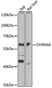 CHRNA6 Antibody - Western blot analysis of extracts of various cell lines, using CHRNA6 antibody at 1:1000 dilution. The secondary antibody used was an HRP Goat Anti-Rabbit IgG (H+L) at 1:10000 dilution. Lysates were loaded 25ug per lane and 3% nonfat dry milk in TBST was used for blocking. An ECL Kit was used for detection and the exposure time was 30s.