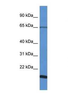 CHRNA6 Antibody - CHRNA6 antibody Western blot of Jurkat Cell lysate. Antibody concentration 1 ug/ml.  This image was taken for the unconjugated form of this product. Other forms have not been tested.