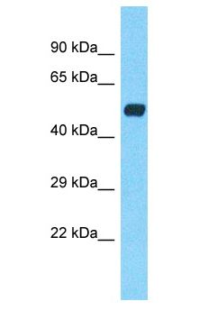 CHRNA7 Antibody - CHRNA7 antibody Western Blot of Liver Tumor. Antibody dilution: 1 ug/ml.  This image was taken for the unconjugated form of this product. Other forms have not been tested.