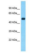 CHRNA7 Antibody - CHRNA7 antibody Western Blot of Liver Tumor. Antibody dilution: 1 ug/ml.  This image was taken for the unconjugated form of this product. Other forms have not been tested.