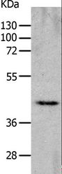 CHRNA7 Antibody - Western blot analysis of Mouse heart tissue, using CHRFAM7A Polyclonal Antibody at dilution of 1:700.