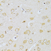 CHRNA7 Antibody - Immunohistochemistry of paraffin-embedded rat brain using CHRNA7 antibodyat dilution of 1:100 (40x lens).