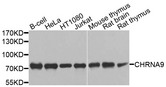 CHRNA9 Antibody - Western blot analysis of extracts of various cells.