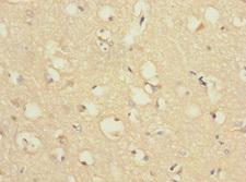 CHRNA9 Antibody - Immunohistochemistry of paraffin-embedded human brain tissue at dilution 1:100