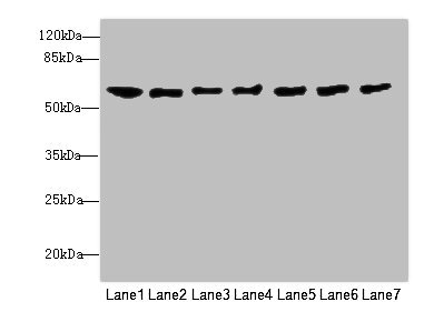 CHRNA9 Antibody - Western blot All Lanes: CHRNA9 antibody at 0.75ug/ml Lane 1: Mouse brain tissue Lane 2: Jurkat whole cell lysate Lane 3: Hela whole cell lysate Lane 4: A549 whole cell lysate Lane 5: A431 whole cell lysate Lane 6: HepG-2 whole cell lysate Lane 7: MCF7 whole cell lysate Secondary Goat polyclonal to rabbit IgG at 1/10000 dilution Predicted band size: 55 kDa Observed band size: 55 kDa