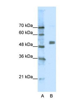CHRNA9 Antibody - CHRNA9 antibody Western blot of Jurkat Cell lysate. Antibody concentration 1 ug/ml. This image was taken for the unconjugated form of this product. Other forms have not been tested.