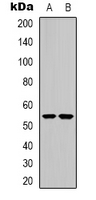 CHRNA9 Antibody - Western blot analysis of CHRNA9 expression in Jurkat (A); HEK293T (B) whole cell lysates.