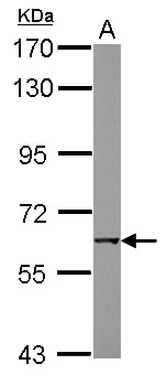 CHRNB1 Antibody - Sample (30 ug of whole cell lysate) A: MCF-7 7.5% SDS PAGE CHRNB1 antibody diluted at 1:1000