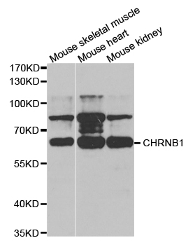 CHRNB1 Antibody - Western blot analysis of extracts of various cell lines, using CHRNB1 antibody.