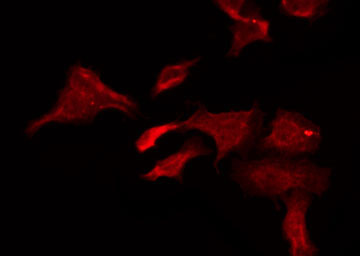 CHRNB1 Antibody - Staining HeLa cells by IF/ICC. The samples were fixed with PFA and permeabilized in 0.1% Triton X-100, then blocked in 10% serum for 45 min at 25°C. The primary antibody was diluted at 1:200 and incubated with the sample for 1 hour at 37°C. An Alexa Fluor 594 conjugated goat anti-rabbit IgG (H+L) Ab, diluted at 1/600, was used as the secondary antibody.