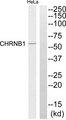 CHRNB1 Antibody - Western blot analysis of extracts from HeLa cells, using CHRNB1 antibody.