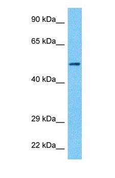 CHRNB1 Antibody - Western blot of ACHB Antibody with human 721_B Whole Cell lysate.  This image was taken for the unconjugated form of this product. Other forms have not been tested.