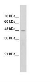 CHRNB2 Antibody - Jurkat Cell Lysate.  This image was taken for the unconjugated form of this product. Other forms have not been tested.