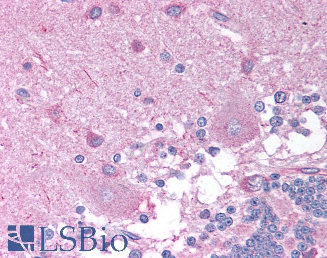 CHRNB2 Antibody - Anti-CHRNB2 antibody IHC of human brain, cerebellum. Immunohistochemistry of formalin-fixed, paraffin-embedded tissue after heat-induced antigen retrieval. Antibody concentration 10 ug/ml.  This image was taken for the unconjugated form of this product. Other forms have not been tested.