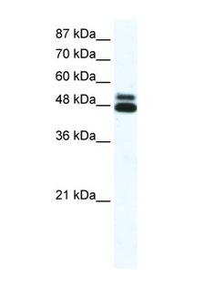 CHRNB2 Antibody - CHRNB2 antibody Western blot of Daudi Cell lysate. Antibody concentration 1 ug/ml. This image was taken for the unconjugated form of this product. Other forms have not been tested.