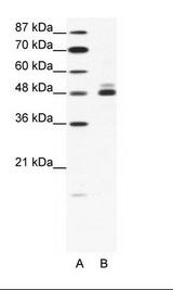 CHRNB2 Antibody - A: Marker, B: HepG2 Cell Lysate.  This image was taken for the unconjugated form of this product. Other forms have not been tested.
