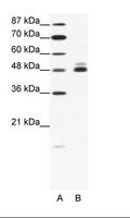 CHRNB2 Antibody - A: Marker, B: HepG2 Cell Lysate.  This image was taken for the unconjugated form of this product. Other forms have not been tested.