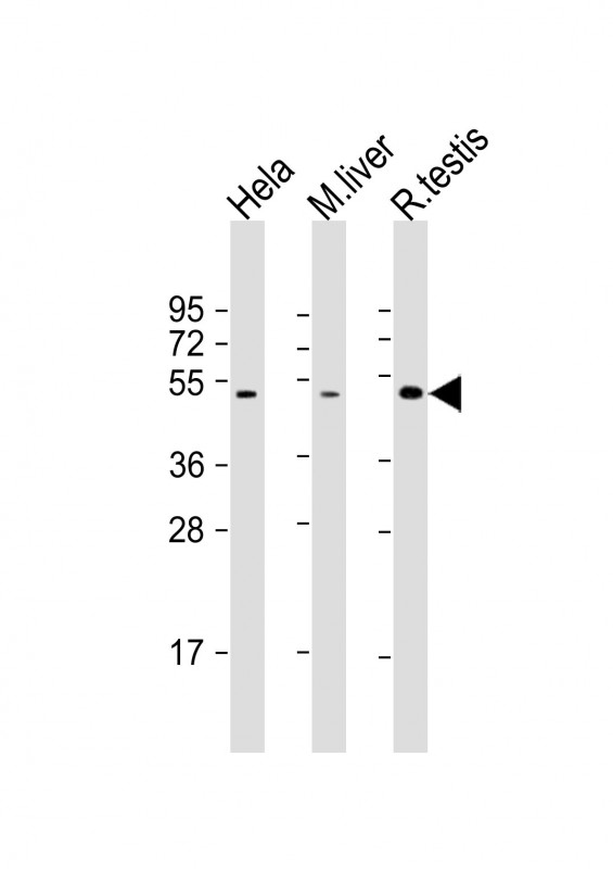 CHRNB2 Antibody - All lanes: Anti-CHRNB2 Antibody (N-Term) at 1:2000 dilution. Lane 1: HeLa whole cell lysate. Lane 2: mouse liver lysate. Lane 3: rat testis lysate Lysates/proteins at 20 ug per lane. Secondary Goat Anti-Rabbit IgG, (H+L), Peroxidase conjugated at 1:10000 dilution. Predicted band size: 57 kDa. Blocking/Dilution buffer: 5% NFDM/TBST.