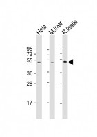 CHRNB2 Antibody - All lanes: Anti-CHRNB2 Antibody (N-Term) at 1:2000 dilution. Lane 1: HeLa whole cell lysate. Lane 2: mouse liver lysate. Lane 3: rat testis lysate Lysates/proteins at 20 ug per lane. Secondary Goat Anti-Rabbit IgG, (H+L), Peroxidase conjugated at 1:10000 dilution. Predicted band size: 57 kDa. Blocking/Dilution buffer: 5% NFDM/TBST.