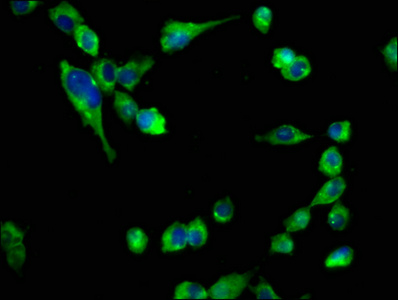 CHRNB2 Antibody - Immunofluorescence staining of SH-SY5Y cells at a dilution of 1:133, counter-stained with DAPI. The cells were fixed in 4% formaldehyde, permeabilized using 0.2% Triton X-100 and blocked in 10% normal Goat Serum. The cells were then incubated with the antibody overnight at 4 °C.The secondary antibody was Alexa Fluor 488-congugated AffiniPure Goat Anti-Rabbit IgG (H+L) .