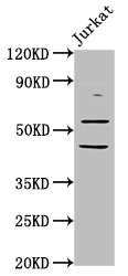 CHRNB2 Antibody - Positive Western Blot detected in Jurkat whole cell lysate. All lanes: CHRNB2 antibody at 6.05 µg/ml Secondary Goat polyclonal to rabbit IgG at 1/50000 dilution. Predicted band size: 58 KDa. Observed band size: 58 KDa