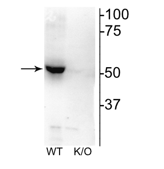 CHRNB2 Antibody - Western blot of mouse habenula lysate showing specific immunolabeling of the ~52 kDa nAChR B2 protein.