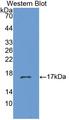 CHRNB3 Antibody - Western blot of CHRNB3 antibody.