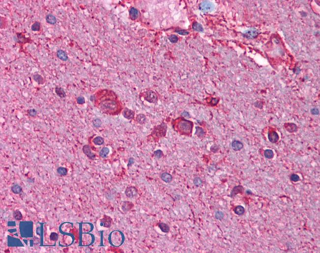 CHRNB3 Antibody - Anti-CHRNB3 antibody IHC of human brain, cortex. Immunohistochemistry of formalin-fixed, paraffin-embedded tissue after heat-induced antigen retrieval. Antibody concentration 5 ug/ml.  This image was taken for the unconjugated form of this product. Other forms have not been tested.