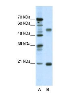 CHRNB3 Antibody - CHRNB3 antibody Western blot of Jurkat Cell lysate. Antibody concentration 1 ug/ml. This image was taken for the unconjugated form of this product. Other forms have not been tested.