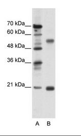 CHRNB3 Antibody - A: Marker, B: Jurkat Cell Lysate.  This image was taken for the unconjugated form of this product. Other forms have not been tested.