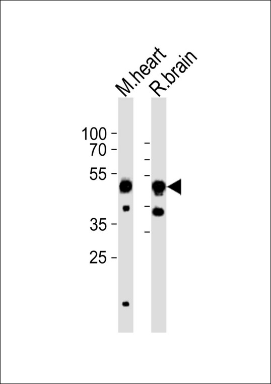 CHRNB3 Antibody - Western blot of lysates from mouse heart, rat brain tissue lysate (from left to right) with CHRNB3 Antibody. Antibody was diluted at 1:1000 at each lane. A goat anti-rabbit IgG H&L (HRP) at 1:10000 dilution was used as the secondary antibody. Lysates at 35 ug per lane.