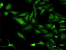 CHRNB3 Antibody - Immunofluorescence of monoclonal antibody to CHRNB3 on HeLa cell . [antibody concentration 10 ug/ml]