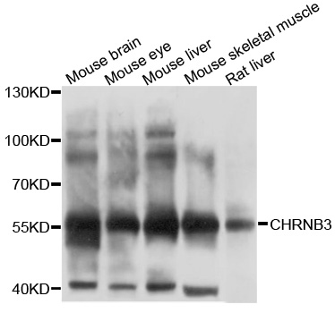CHRNB3 Antibody - Western blot analysis of extracts of various cell lines, using CHRNB3 antibody at 1:1000 dilution. The secondary antibody used was an HRP Goat Anti-Rabbit IgG (H+L) at 1:10000 dilution. Lysates were loaded 25ug per lane and 3% nonfat dry milk in TBST was used for blocking. An ECL Kit was used for detection and the exposure time was 10s.