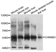 CHRNB3 Antibody - Western blot analysis of extracts of various cell lines, using CHRNB3 antibody at 1:1000 dilution. The secondary antibody used was an HRP Goat Anti-Rabbit IgG (H+L) at 1:10000 dilution. Lysates were loaded 25ug per lane and 3% nonfat dry milk in TBST was used for blocking. An ECL Kit was used for detection and the exposure time was 10s.