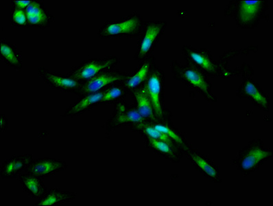 CHRNB3 Antibody - Immunofluorescence staining of Hela cells at a dilution of 1:133, counter-stained with DAPI. The cells were fixed in 4% formaldehyde, permeabilized using 0.2% Triton X-100 and blocked in 10% normal Goat Serum. The cells were then incubated with the antibody overnight at 4°C.The secondary antibody was Alexa Fluor 488-congugated AffiniPure Goat Anti-Rabbit IgG (H+L) .
