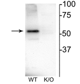 CHRNB4 Antibody - Western blot of mouse habenula lysate showing specific immunolabeling of the ~52 kDa nAChR B4 protein.