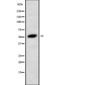 CHRNB4 Antibody - Western blot analysis of CHRNB4 using HuvEc whole cells lysates