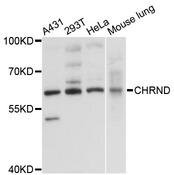 CHRND Antibody - Western blot analysis of extracts of various cell lines, using CHRND antibody at 1:3000 dilution. The secondary antibody used was an HRP Goat Anti-Rabbit IgG (H+L) at 1:10000 dilution. Lysates were loaded 25ug per lane and 3% nonfat dry milk in TBST was used for blocking. An ECL Kit was used for detection and the exposure time was 30s.