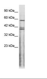 CHRND Antibody - Jurkat Cell Lysate.  This image was taken for the unconjugated form of this product. Other forms have not been tested.