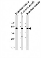 CHRNE Antibody - All lanes: Anti-CHRNE Antibody (Center) at 1:2000 dilution Lane 1: Human skeletal muslce lysate Lane 2: Mouse skeletal muscle lysate Lane 3: Rat skeletal muscle lysate Lysates/proteins at 20 µg per lane. Secondary Goat Anti-Rabbit IgG, (H+L), Peroxidase conjugated at 1/10000 dilution. Predicted band size: 55 kDa Blocking/Dilution buffer: 5% NFDM/TBST.
