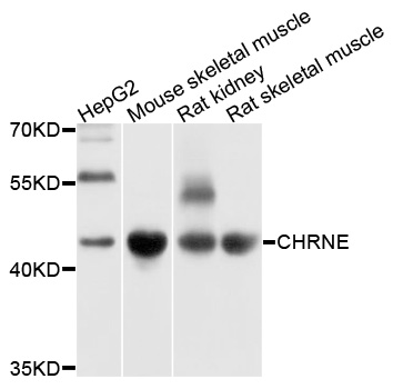 CHRNE Antibody - Western blot analysis of extracts of various cell lines, using CHRNE antibody at 1:1000 dilution. The secondary antibody used was an HRP Goat Anti-Rabbit IgG (H+L) at 1:10000 dilution. Lysates were loaded 25ug per lane and 3% nonfat dry milk in TBST was used for blocking. An ECL Kit was used for detection and the exposure time was 1s.