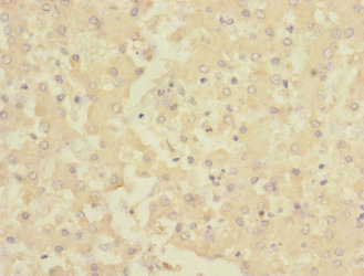 CHRNE Antibody - Immunohistochemistry of paraffin-embedded human liver tissue at dilution 1:100