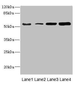 CHRNE Antibody - Western blot All Lanes: CHRNE antibody at 1.87ug/ml Lane 1: A549 whole cell lysate Lane 2: Jurkat whole cell lysate Lane 3: Hela whole cell lysate Lane 4: HepG-2 whole cell lysate Secondary Goat polyclonal to rabbit IgG at 1/10000 dilution Predicted band size: 55 kDa Observed band size: 55 kDa