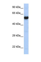 CHRNG Antibody - CHRNG antibody Western blot of MCF7 Cell lysate. Antibody concentration 1 ug/ml. This image was taken for the unconjugated form of this product. Other forms have not been tested.